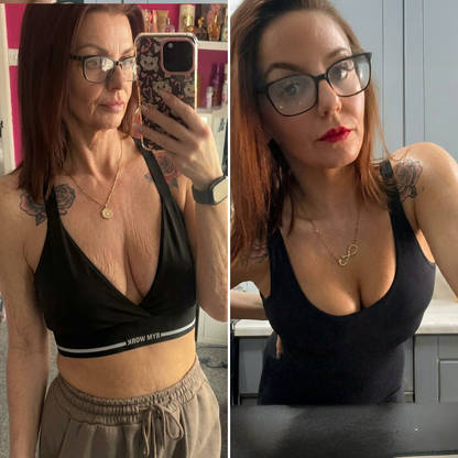 🎁🎁🎁𝐇𝐈𝐒𝐊𝐈𝐍® Zbývá už jen 10 balíčků! Dáváme vám navíc 50% slevu! Pečujte o svou postavu a zdraví! Pokud to teď propásnete, další příležitost bude až příští rok.