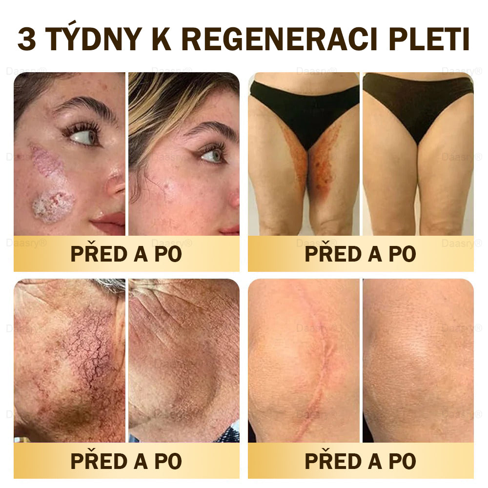 𝓓𝓪𝓪𝓼𝓻𝔂®Krém s včelím jedem pro obnovu a omlazení pleti. Snižuje vrásky, hydratuje, rozjasňuje, hojí jizvičky, zklidňuje citlivou pleť a sjednocuje barvu pleti.