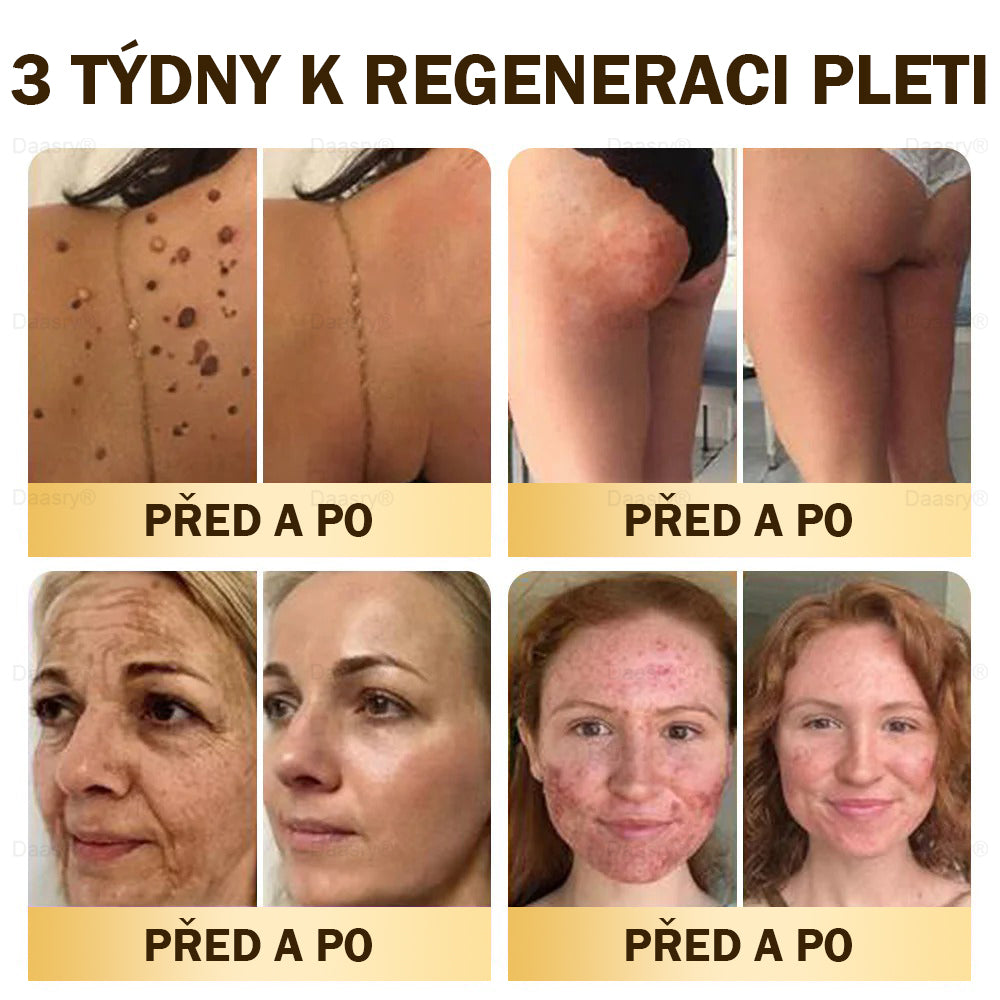 𝓓𝓪𝓪𝓼𝓻𝔂®Krém s včelím jedem pro obnovu a omlazení pleti. Snižuje vrásky, hydratuje, rozjasňuje, hojí jizvičky, zklidňuje citlivou pleť a sjednocuje barvu pleti.