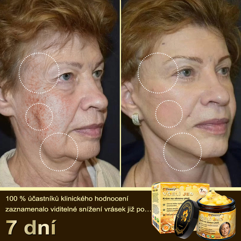 𝓓𝓪𝓪𝓼𝓻𝔂®Krém s včelím jedem pro obnovu a omlazení pleti. Snižuje vrásky, hydratuje, rozjasňuje, hojí jizvičky, zklidňuje citlivou pleť a sjednocuje barvu pleti.