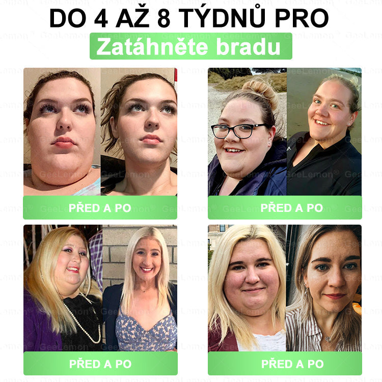 🏥 AMZKEEP® NAD+ Moringa Berberin AMPK nano-mikrojehličková náplast ✅ 1× denně, viditelné změny za 7 dní｜Berberin + moringa｜Na obezitu, povolenou kůži, cukrovku, spánkovou apnoi, kloubní potíže a další 💯🚀