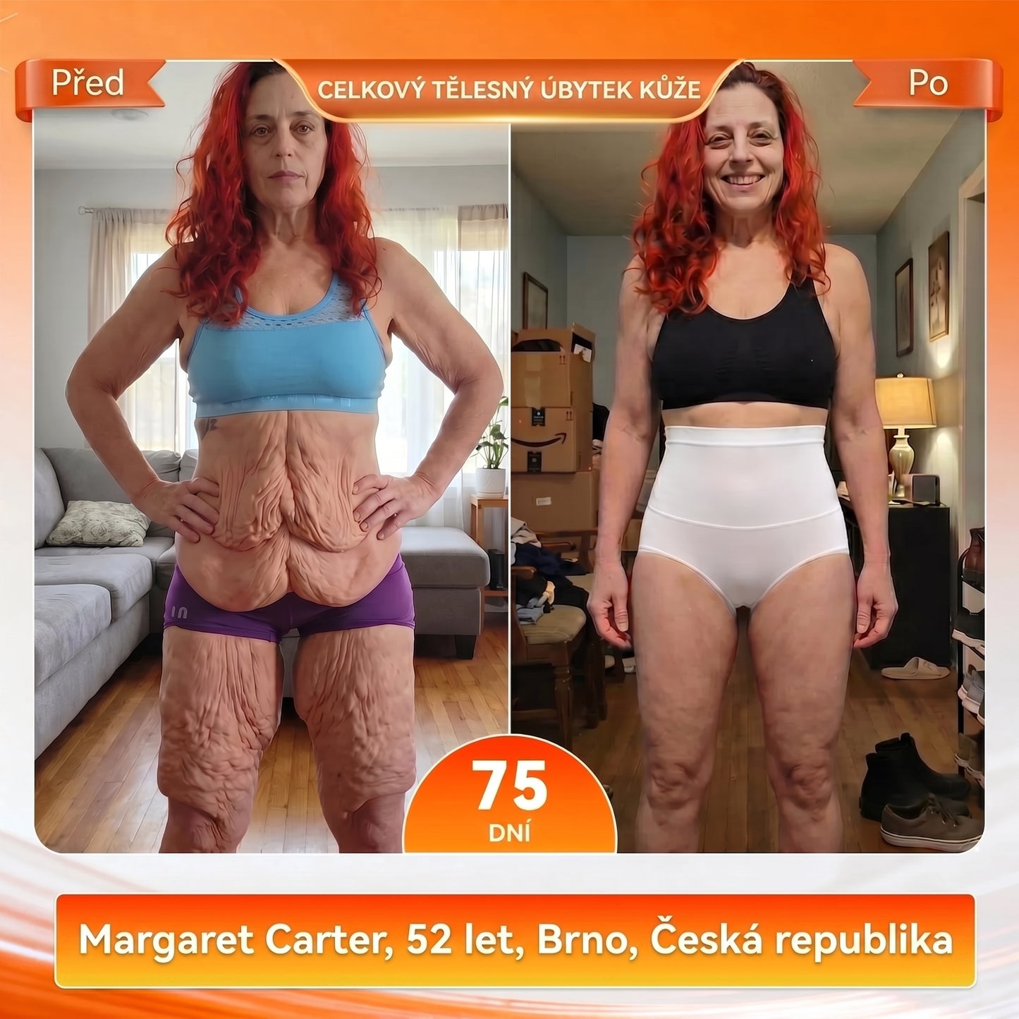 𝑶𝒇𝒊𝒄𝒊á𝒍𝒏í 𝒛𝒏𝒂č𝒌𝒐𝒗ý 𝒐𝒃𝒄𝒉𝒐𝒅 💎 𝑨𝑳𝑳𝒀𝑩𝑬𝑬® 2026 𝑴𝒐𝒓𝒊𝒏𝒈𝒂 & 𝑩𝒆𝒓𝒃𝒆𝒓𝒊𝒏 4𝒗1 𝒎𝒊𝒌𝒓𝒐čá𝒔𝒕𝒊𝒄𝒐𝒗é 𝒕𝒗𝒂𝒓𝒐𝒗𝒂𝒄í 𝒂 𝒔𝒑𝒂𝒍𝒐𝒗𝒂𝒄í 𝒌𝒓𝒂ť𝒂𝒔𝒚