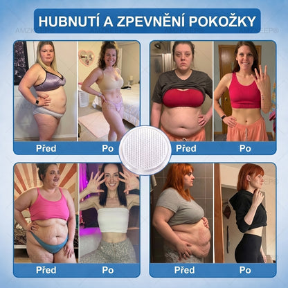 🇨🇿𝐀𝗠𝒁𝑲𝗘𝗘𝙋® 𝐀𝗠𝗣𝑲 𝐌𝗼𝗿𝗶𝗻𝗴𝗮 𝐁𝗲𝗿𝗯𝗲𝗿𝗶𝗻 𝟏𝟎-𝐯-𝟏 𝐌𝗲𝘁𝗮𝗯𝗼𝗹𝗶𝗰𝗸á 𝐏𝗼𝗱𝗽𝗼𝗿𝗮 𝐍𝗮𝗻𝗼 𝐌𝗶𝗸𝗿𝗼𝗷𝗲𝗵𝗹𝗶č𝗸𝗼𝘃á 𝐍á𝗽𝗹𝗮𝘀𝘁 🇨🇿 (Pouze jednou denně, viditelné výsledky za 7 dní) ✅ Pro nadváhu, povolenou pokožku, metabolickou nerovnováhu, problémy se spánkem, klouby a další
