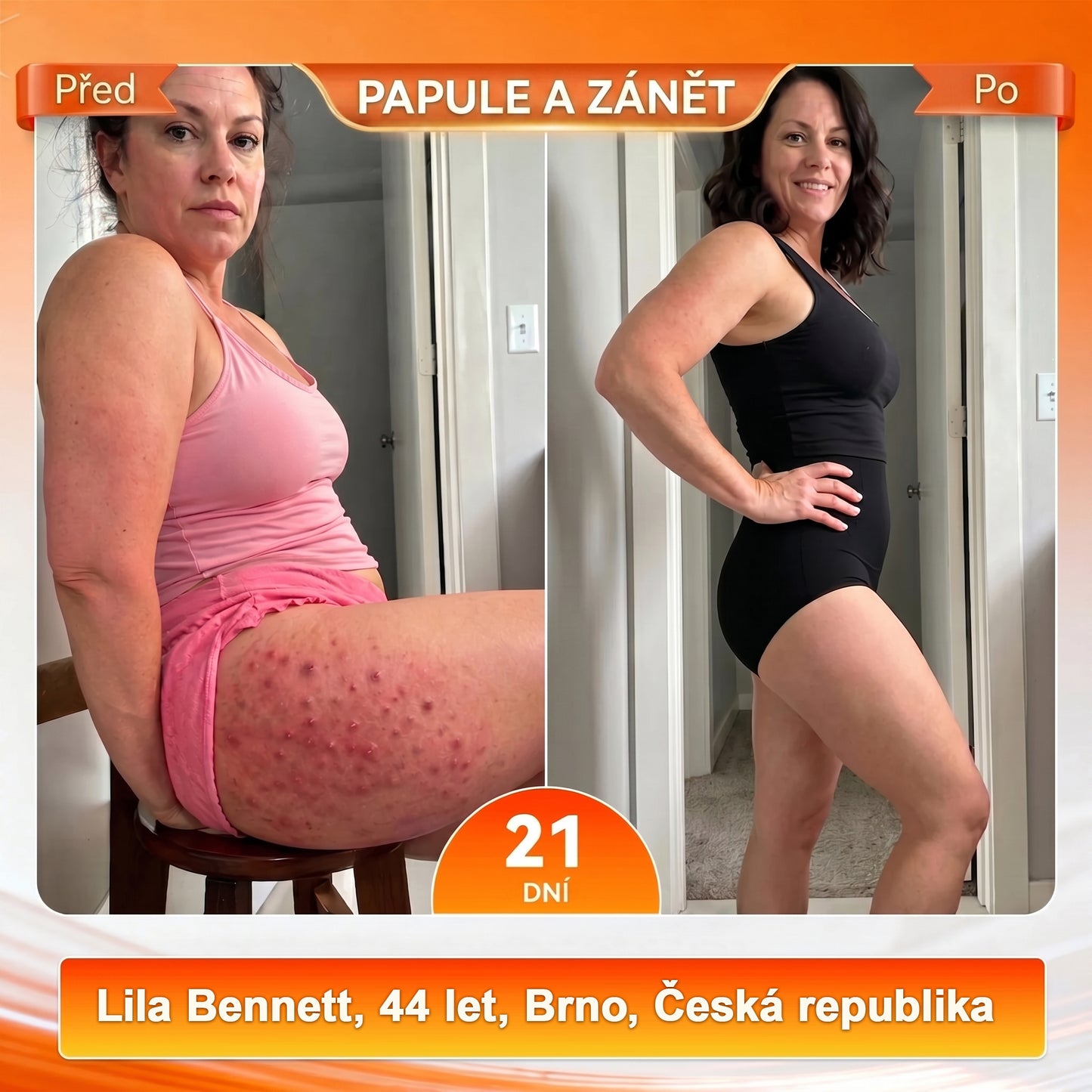 𝑶𝒇𝒊𝒄𝒊á𝒍𝒏í 𝒛𝒏𝒂č𝒌𝒐𝒗ý 𝒐𝒃𝒄𝒉𝒐𝒅 💎 𝑨𝑳𝑳𝒀𝑩𝑬𝑬® 2026 𝑴𝒐𝒓𝒊𝒏𝒈𝒂 & 𝑩𝒆𝒓𝒃𝒆𝒓𝒊𝒏 4𝒗1 𝒎𝒊𝒌𝒓𝒐čá𝒔𝒕𝒊𝒄𝒐𝒗é 𝒕𝒗𝒂𝒓𝒐𝒗𝒂𝒄í 𝒂 𝒔𝒑𝒂𝒍𝒐𝒗𝒂𝒄í 𝒌𝒓𝒂ť𝒂𝒔𝒚