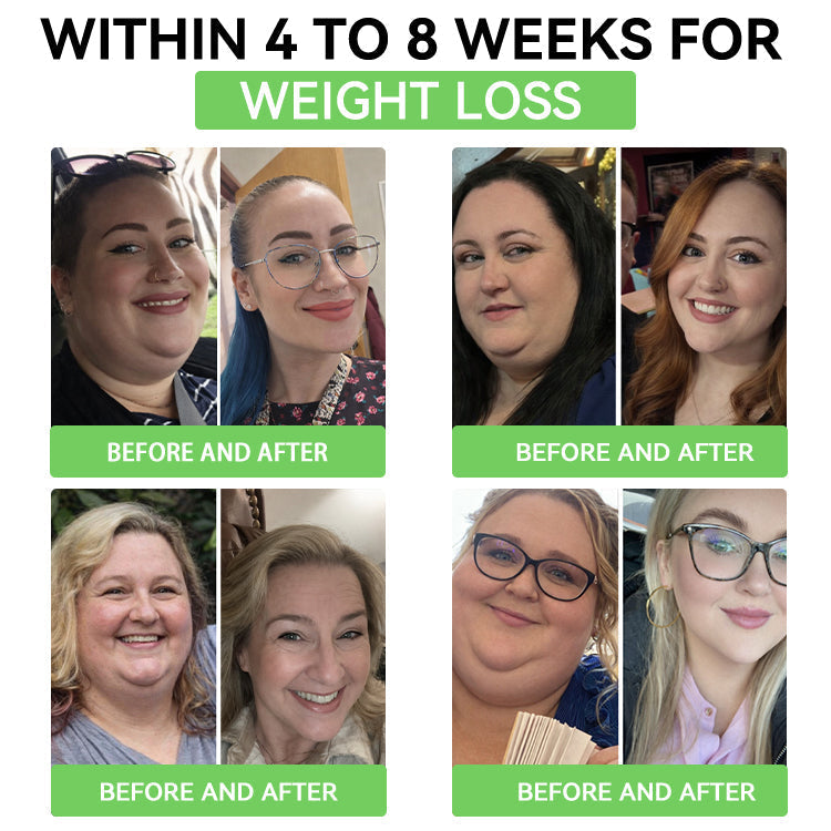 🏥𝐀𝐌𝐙𝐊𝐄𝐄𝐏® 𝐍𝐀𝐃+ 𝐌𝐨𝐫𝐢𝐧𝐠𝐚 𝐁𝐞𝐫𝐛𝐞𝐫𝐢𝐧𝐞 𝐀𝐌𝐏𝐊 𝐒𝐮𝐩𝐩𝐨𝐫𝐭 𝐍𝐚𝐧𝐨 𝐌𝐢𝐜𝐫𝐨𝐧𝐞𝐞𝐝𝐥𝐞 𝐏𝐚𝐭𝐜𝐡✅（𝐉𝐮𝐬𝐭 𝐨𝐧𝐜𝐞 𝐚 𝐝𝐚𝐲, 𝐯𝐢𝐬𝐢𝐛𝐥𝐞 𝐜𝐡𝐚𝐧𝐠𝐞𝐬 𝐢𝐧 𝟕 𝐝𝐚𝐲𝐬) ｜𝐁𝐞𝐫𝐛𝐞𝐫𝐢𝐧𝐞 + 𝐌𝐨𝐫𝐢𝐧𝐠𝐚 𝐅𝐨𝐫𝐦𝐮𝐥𝐚 ｜𝐅𝐨𝐫 𝐨𝐛𝐞𝐬𝐢𝐭𝐲, 𝐋𝐨𝐨𝐬𝐞 𝐬𝐤𝐢𝐧, 𝐝𝐢𝐚𝐛𝐞𝐭𝐞𝐬, 𝐬𝐥𝐞𝐞𝐩 𝐚𝐩𝐧𝐞𝐚, 𝐣𝐨𝐢𝐧𝐭 𝐢𝐬𝐬𝐮𝐞𝐬, 𝐚𝐧𝐝 𝐦𝐨𝐫𝐞 💯🚀