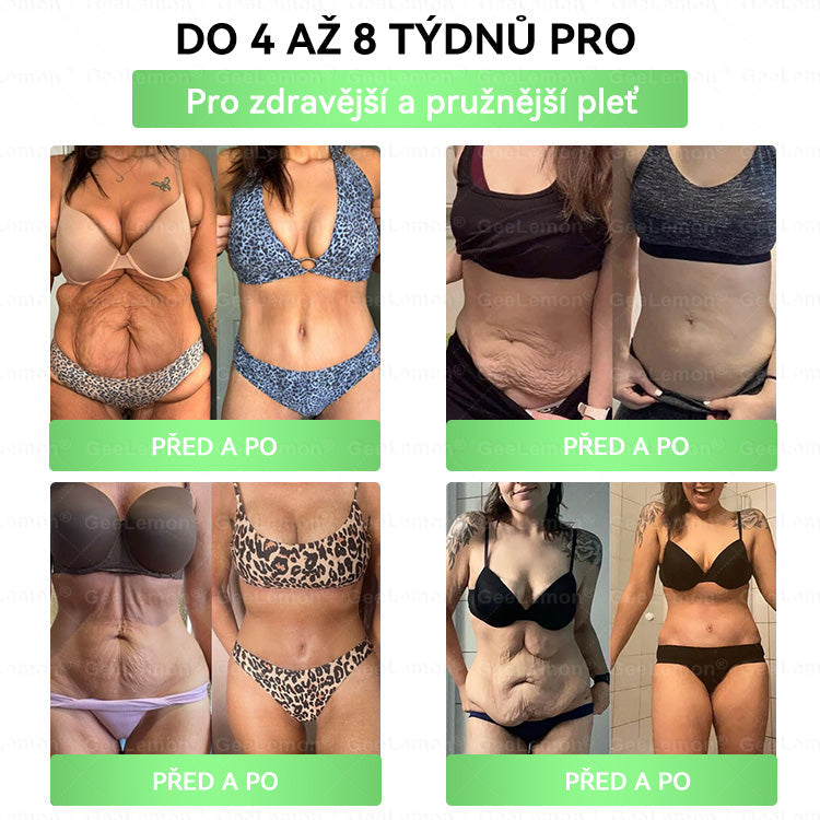 🏥 AMZKEEP® NAD+ Moringa Berberin AMPK nano-mikrojehličková náplast ✅ 1× denně, viditelné změny za 7 dní｜Berberin + moringa｜Na obezitu, povolenou kůži, cukrovku, spánkovou apnoi, kloubní potíže a další 💯🚀