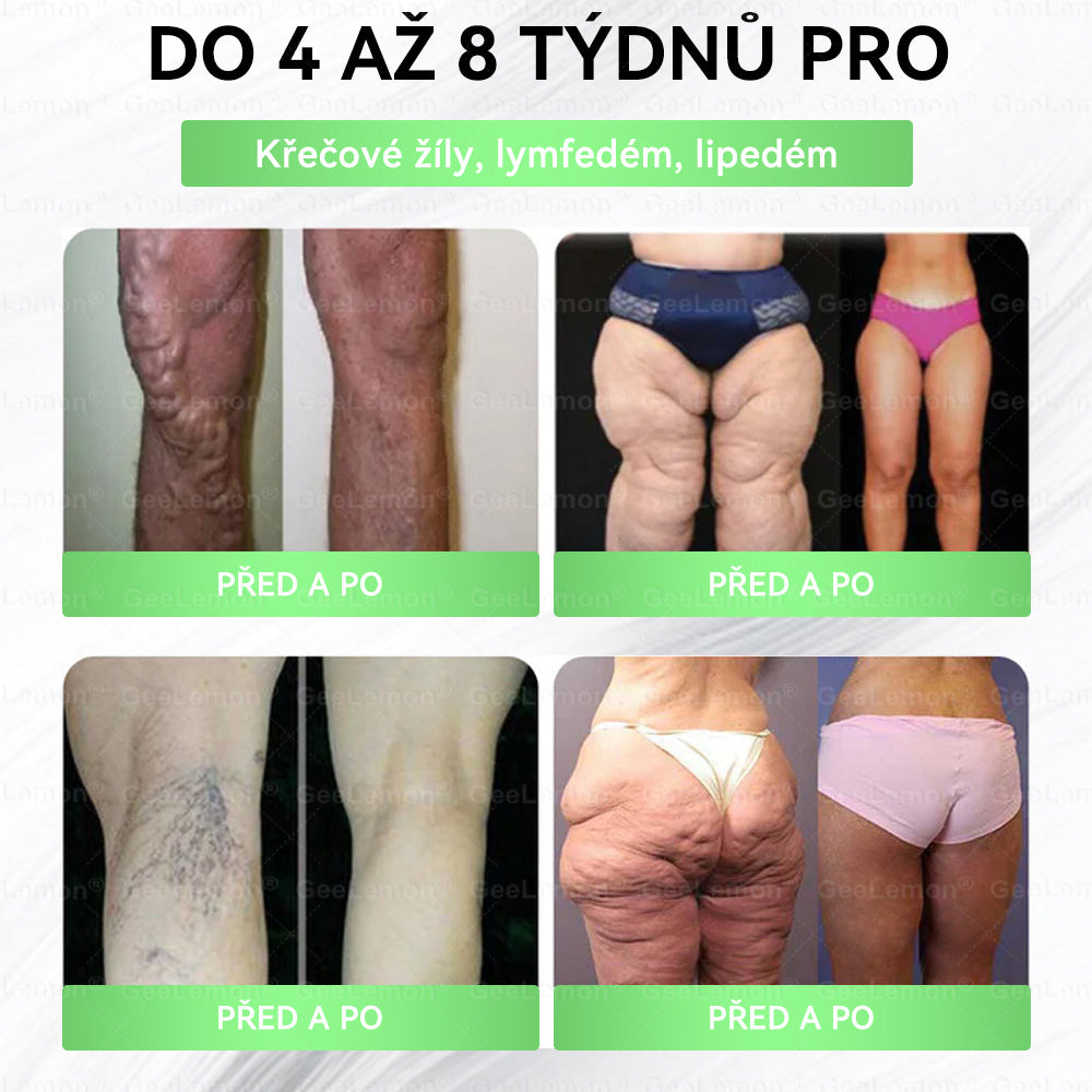 🏥 AMZKEEP® NAD+ Moringa Berberin AMPK nano-mikrojehličková náplast ✅ 1× denně, viditelné změny za 7 dní｜Berberin + moringa｜Na obezitu, povolenou kůži, cukrovku, spánkovou apnoi, kloubní potíže a další 💯🚀