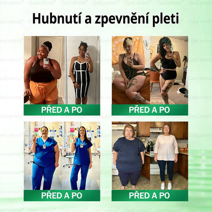 🏥 AMZKEEP® NAD+ Moringa Berberin AMPK nano-mikrojehličková náplast ✅ 1× denně, viditelné změny za 7 dní｜Berberin + moringa｜Na obezitu, povolenou kůži, cukrovku, spánkovou apnoi, kloubní potíže a další 💯🚀