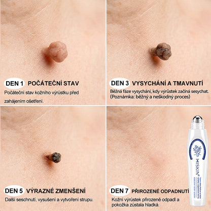 Oficiální značkový obchod | 🐬Hiskin® 7denní odstraňovač skvrn a pigmentových skvrn (Bezbolestný rollerball bez jizev)