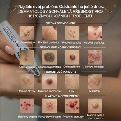 Oficiální značkový obchod | 🐬Hiskin® 7denní odstraňovač skvrn a pigmentových skvrn (Bezbolestný rollerball bez jizev)