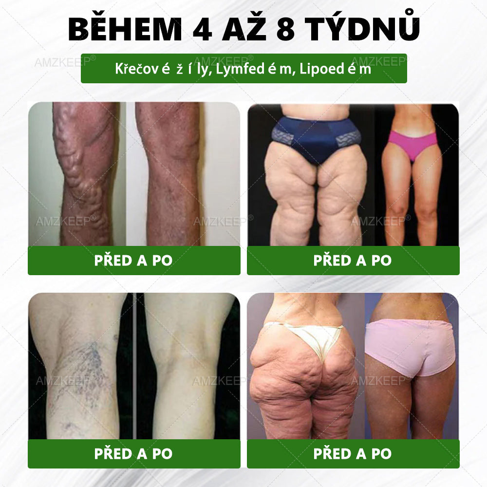 Jako vážený zákazník jste odemkli opravdu speciální bonus. Získejte 50% slevu, když si do objednávky přidáte další produkt AMZKEEP®. Tahle překvapivá nabídka platí jen krátkou dobu.