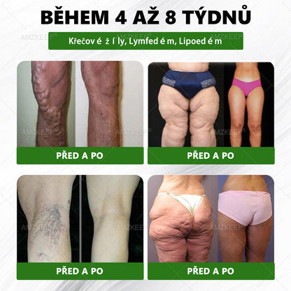 Jako vážený zákazník jste odemkli opravdu speciální bonus. Získejte 50% slevu, když si do objednávky přidáte další produkt AMZKEEP®. Tahle překvapivá nabídka platí jen krátkou dobu.