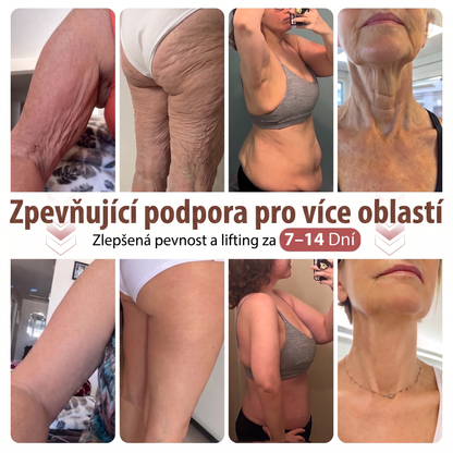 🎁🎁🎁𝐇𝐈𝐒𝐊𝐈𝐍® Zbývá už jen 10 balíčků! Dáváme vám navíc 50% slevu! Pečujte o svou postavu a zdraví! Pokud to teď propásnete, další příležitost bude až příští rok.